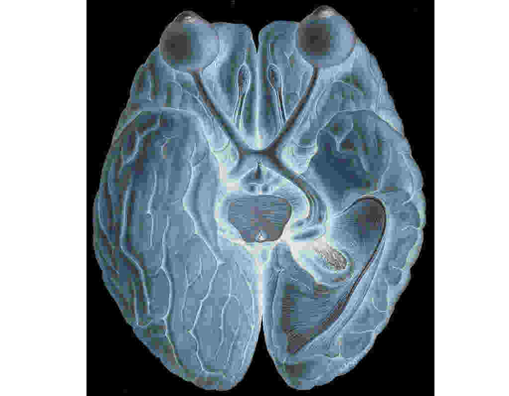 Menschliches Gehirn: Hier klicken fr greres Bild